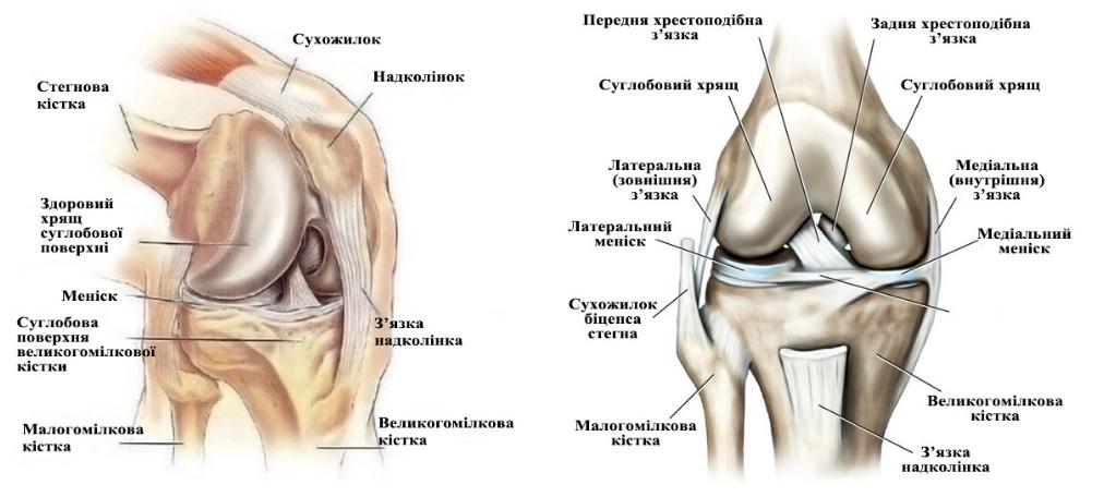 Гонартроз - деформівний (деформуючий) артроз колінного суглоба